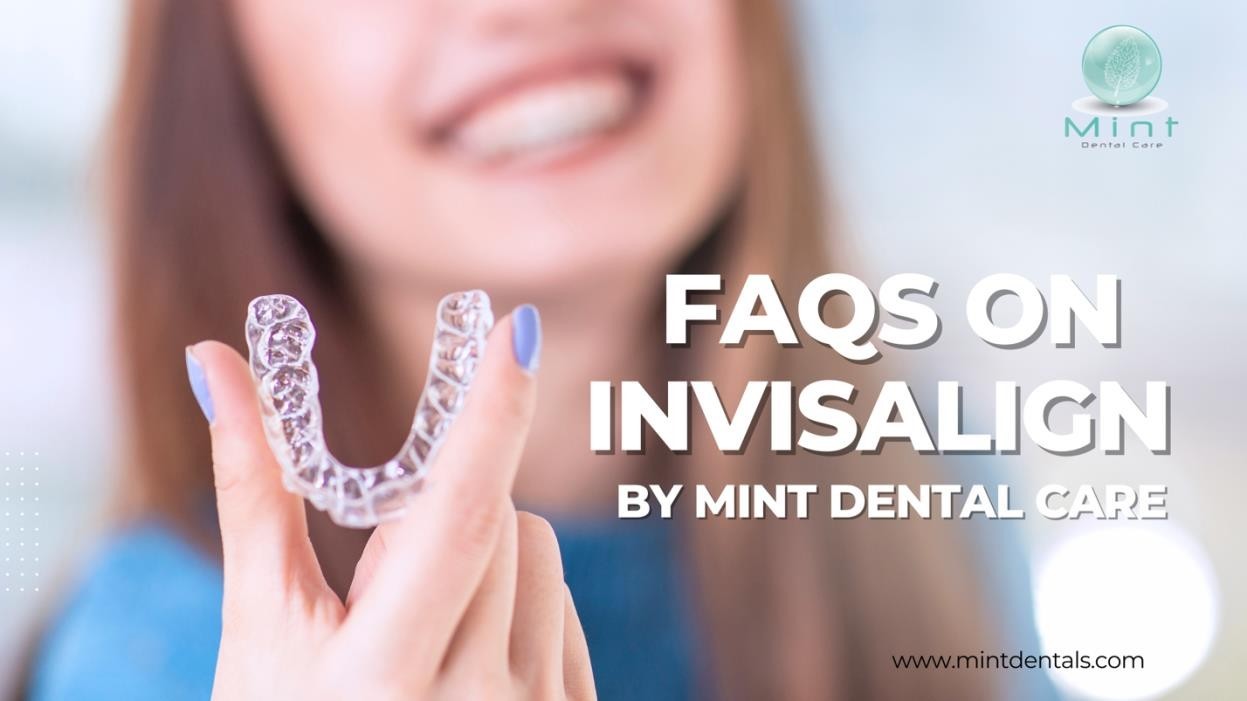 5 Frequently Asked Questions (FAQs) about Invisalign
