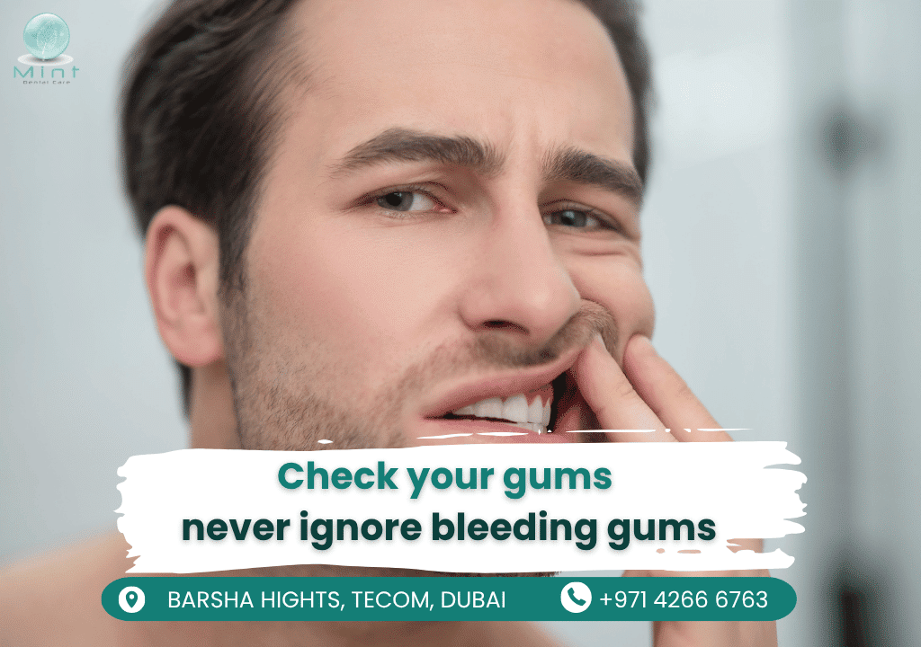 Illustration showing inflamed, bleeding gums as an early warning sign of gum disease requiring dental attention.