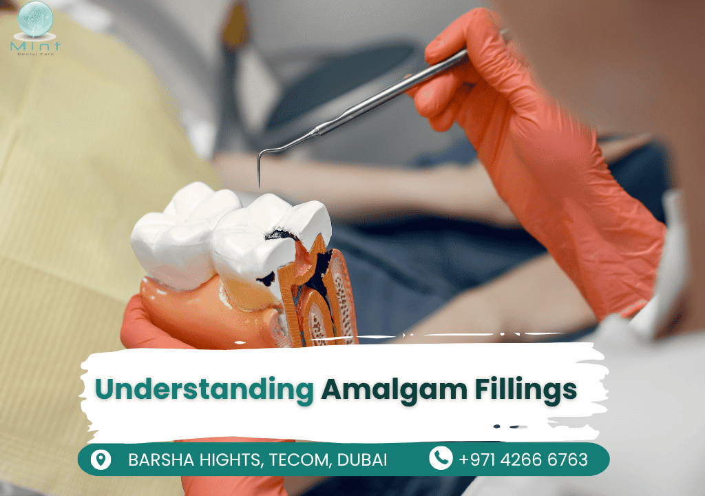 Silver amalgam dental filling in molar tooth