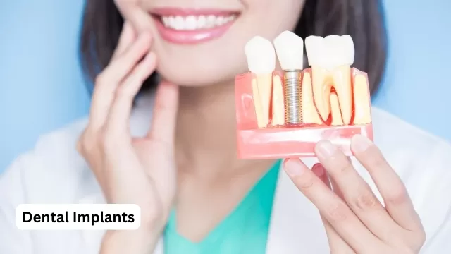 Dental Implants