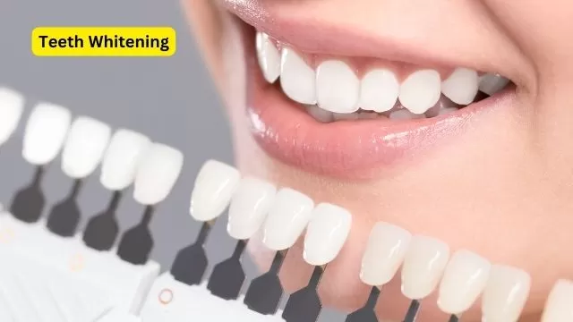 Teeth Whitening