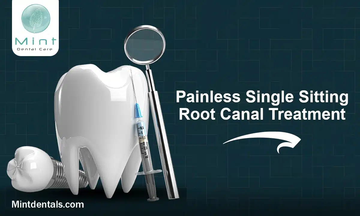 Dentist performing a root canal treatment on a patient.