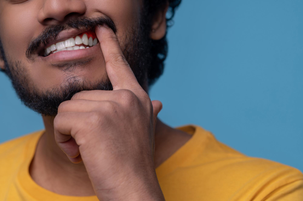 Illustration showing symptoms of gum disease, including swollen and bleeding gums