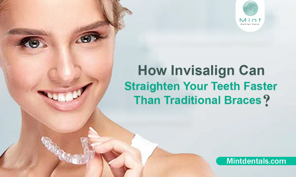 How Invisalign Can Straighten Your Teeth Faster Than Traditional Braces