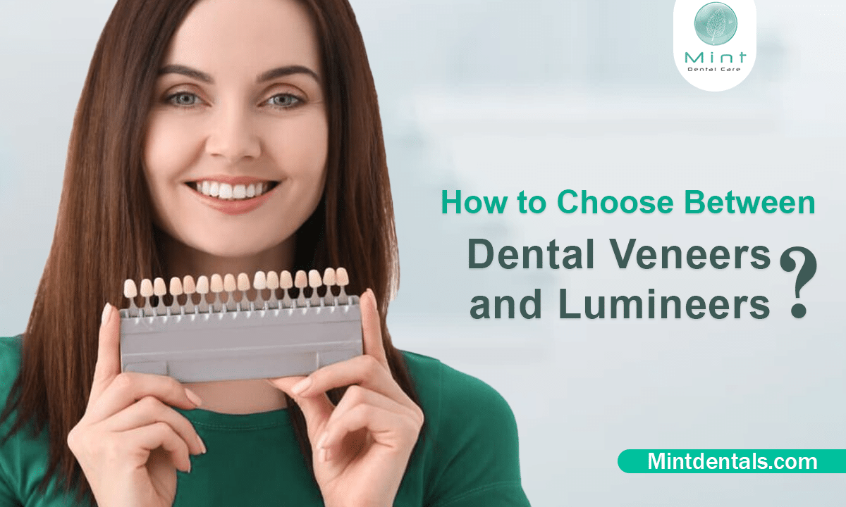 How to Choose Between Dental Veneers and Lumineers