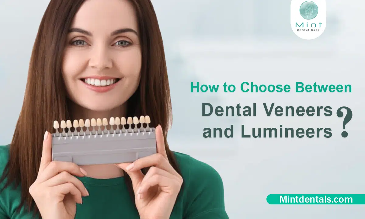 How to Choose Between Dental Veneers and Lumineers