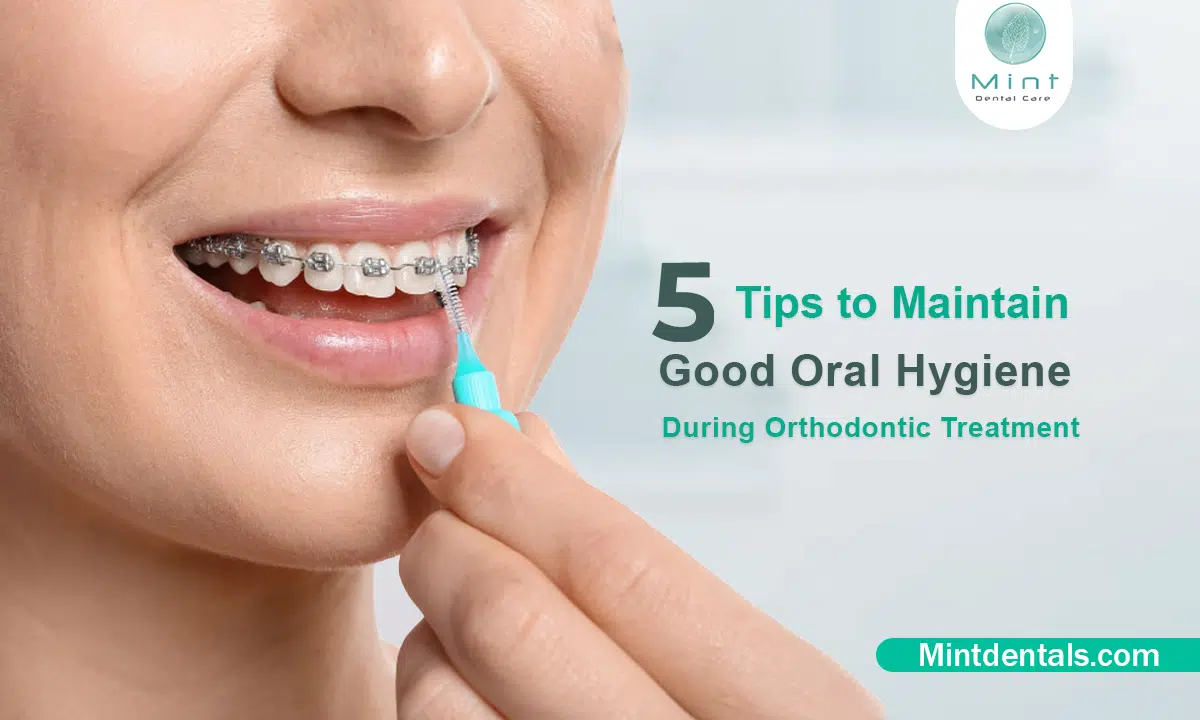 5 Tips to Maintain Good Oral Hygiene During Orthodontic Treatment