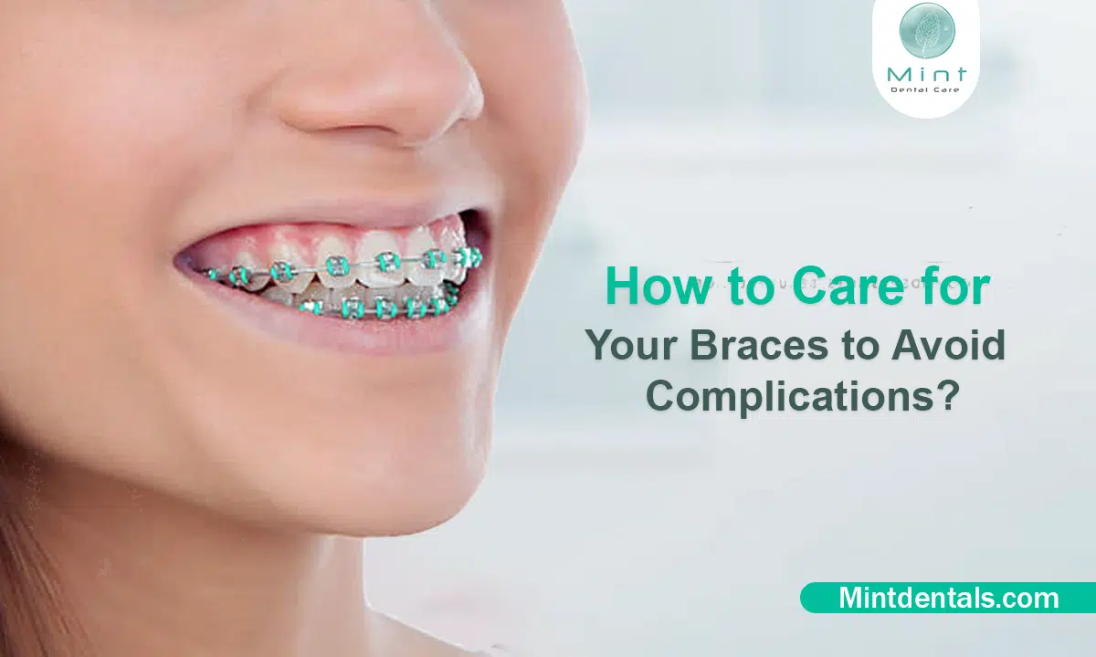 How to Care for Your Braces to Avoid Complications