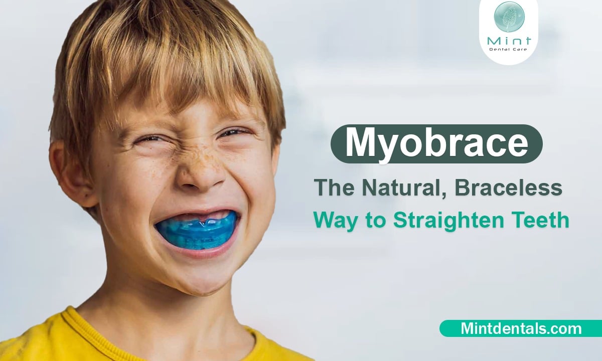 The Concept Behind Myobrace The Myobrace system stands apart from traditional orthodontic treatments. Rather than relying solely on external forces like brackets and wires to move the teeth, Myobrace works by guiding the development of the jaw and oral habits to achieve a more natural alignment. It utilizes a series of custom-made, removable appliances designed to address specific issues, including mouth breathing, tongue thrusting, and improper swallowing patterns. By wearing the appliance for a few hours during the day and overnight, patients can gradually achieve a healthier bite and improved overall oral health without the discomfort often associated with braces. A Holistic Approach to Oral Health The beauty of Myobrace lies in its holistic philosophy. It’s not just about straightening teeth; it’s about cultivating better habits that can last a lifetime. Children often develop habits like mouth breathing or thumb sucking that can adversely affect jaw growth and tooth alignment. Myobrace aims to retrain these habits, guiding the child towards correct swallowing techniques and encouraging nasal breathing. This approach not only promotes better alignment but also enhances facial development and supports healthy respiratory function, making it a comprehensive solution for long-term well-being. Ideal Timing for Myobrace Treatment While Myobrace can be used by people of all ages, it proves especially effective when introduced early in childhood. Starting treatment during a child’s developmental years allows for the correction of poor oral habits before they become deeply ingrained and helps prevent more serious orthodontic issues from arising later on. At Mint Dental Care, we believe that early intervention can lead to more predictable and shorter treatment times, ensuring that young patients can enjoy the benefits of a healthy smile with less disruption to their lives. Comparing Myobrace with Traditional Braces Many parents ask whether Myobrace is truly a better option than traditional braces for their child. While both methods aim to achieve the same end goal—straight teeth and a proper bite—the journey is quite different. Braces use metal brackets and wires to gradually shift teeth into place, which can cause discomfort, difficulty in cleaning, and restrictions in diet. Myobrace, on the other hand, works with the body’s natural growth patterns, correcting habits and encouraging proper jaw development over time. This makes it a preferred choice for those seeking a less invasive, more comfortable alternative. Comfort and Convenience of Myobrace Wearing a Myobrace appliance is a simpler, more convenient experience compared to traditional braces. The appliance is made from a soft material that sits comfortably in the mouth, without the need for metal attachments or frequent tightening visits. Since it only needs to be worn for a few hours daily and while sleeping, children can go about their regular activities with minimal interruption. At Mint Dental Care, we find that patients appreciate this flexibility, which allows them to continue enjoying the foods they love and maintaining their oral hygiene with ease. Myobrace as a Long-Lasting Solution The results of Myobrace are not just temporary; with consistent use and the adoption of healthier oral habits, the changes can be lasting. The key to the success of Myobrace lies in addressing the root causes of misalignment. By retraining the muscles involved in swallowing and breathing, and by guiding the growth of the jaw, patients can achieve stability in their dental alignment. Regular follow-ups at Mint Dental Care help to ensure that progress is on track, and any adjustments are made to maintain the desired results over the long term. Supporting Overall Health Through Myobrace Myobrace is more than an orthodontic solution—it’s an investment in overall health. By promoting correct jaw alignment and functional breathing patterns, it helps reduce the risks associated with mouth breathing, such as poor oxygen intake and sleep disturbances. Proper nasal breathing encouraged by the Myobrace system not only supports dental health but also improves general well-being, as it contributes to better sleep quality, enhanced facial development, and optimal respiratory health. Getting Started with Myobrace at Mint Dental Care Embarking on a Myobrace journey at Mint Dental Care begins with a thorough consultation. During this visit, our pediatric dentist will carefully evaluate your child’s teeth, jaw alignment, and oral habits to determine if Myobrace is the right fit. We will also discuss lifestyle factors that could be contributing to oral health issues and outline a personalized treatment plan that addresses your child’s unique needs. Once you decide to proceed, impressions of the mouth are taken to craft a custom-fit appliance that feels comfortable and is designed to promote the best possible outcomes. Caring for Kids and Adults with Myobrace Although Myobrace is most commonly used for children, it is not exclusive to young patients. Teenagers and adults who are looking for a natural, less noticeable orthodontic solution can also benefit from Myobrace. For adults, the appliance can be particularly helpful in correcting mild alignment issues, addressing jaw pain, and improving improper bite patterns. At Mint Dental Care, we find that adult patients appreciate the opportunity to pursue orthodontic treatment in a way that fits seamlessly into their busy lifestyles. Why Choose Mint Dental Care for Your Myobrace Journey At Mint Dental Care in Dubai, our commitment goes beyond just providing orthodontic solutions. We offer a patient-centered experience that prioritizes comfort, convenience, and comprehensive care. Our specialists take the time to guide you through each step of the process, ensuring that you feel confident in your decision to choose Myobrace. The warm, child-friendly atmosphere of our clinic and our dedication to using innovative, holistic approaches make us the ideal choice for families seeking the best in dental care. Moving Forward with Natural Orthodontics Choosing Myobrace is choosing a path towards natural growth and development, where the focus is on creating the conditions for healthy teeth and a beautiful smile without resorting to invasive procedures. Whether you’re a parent looking to start early intervention for your child or an adult seeking a less conventional approach to straightening teeth, the Myobrace system offers a gentle yet effective solution. At Mint Dental Care, we are here to support you at every stage of your Myobrace journey, from the first consultation to the final results.