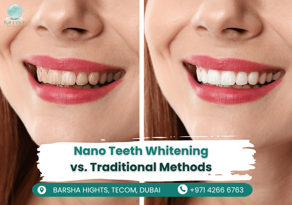Side-by-side comparison of Nano Teeth Whitening (left) and traditional whitening (right), showing how nanoparticles penetrate enamel vs. surface-only bleaching agents.