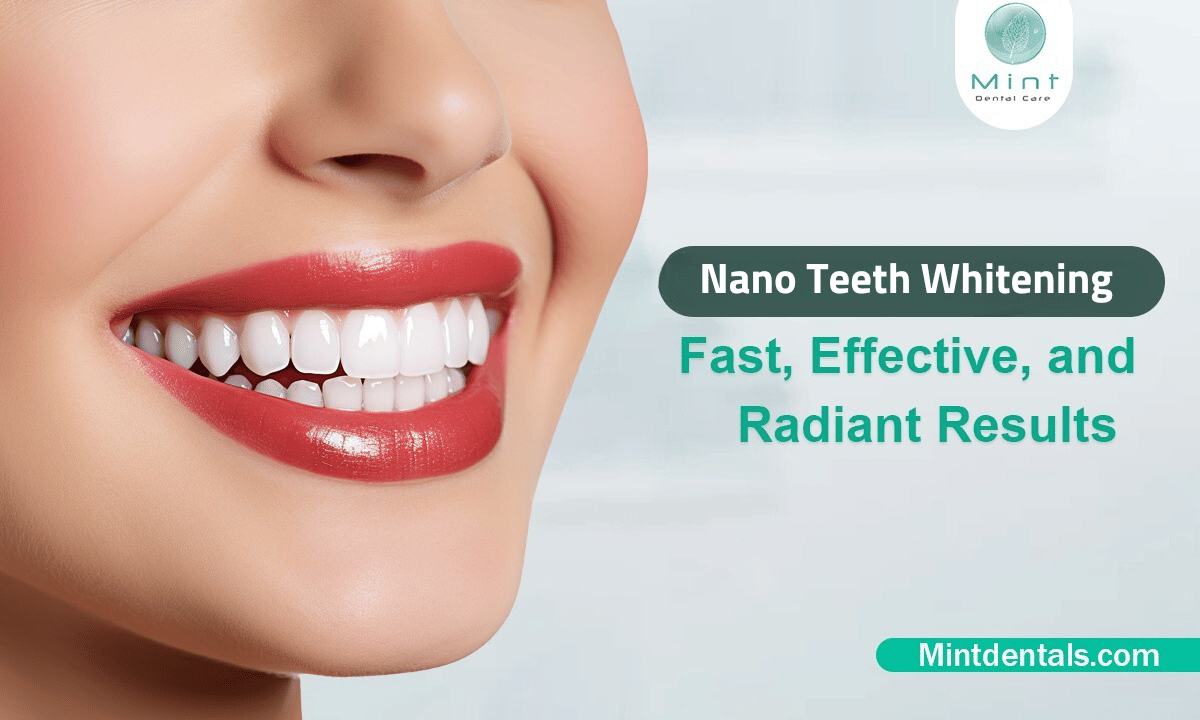 Nano Teeth Whitening vs. Traditional Teeth Whitening