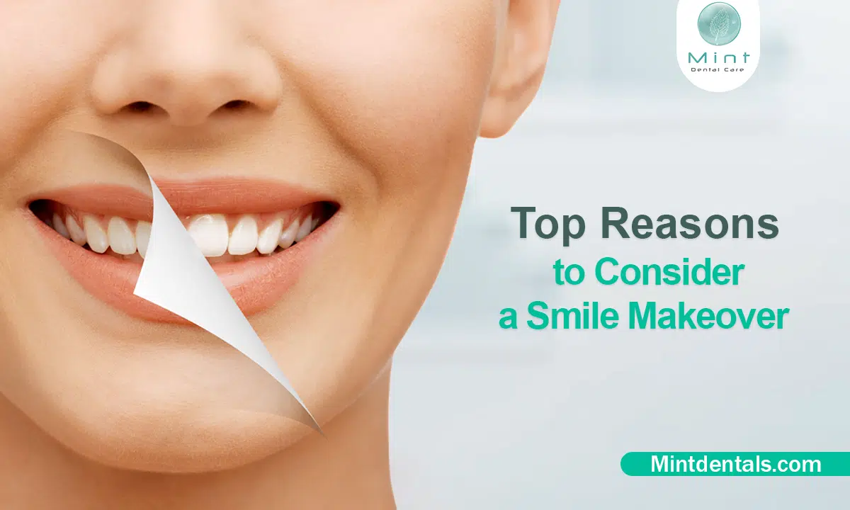 Top Reasons to Consider a Smile Makeover