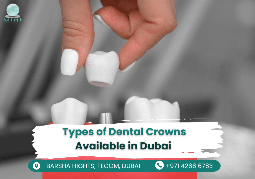 Natural-looking porcelain crowns on front teeth, mimicking enamel translucency for stain-resistant, aesthetic smiles