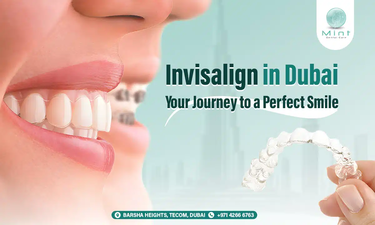 Invisalign in Dubai: Your Journey to a Perfect Smile