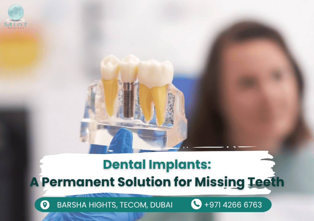 A before-and-after comparison of a patient’s smile restored with dental implants.