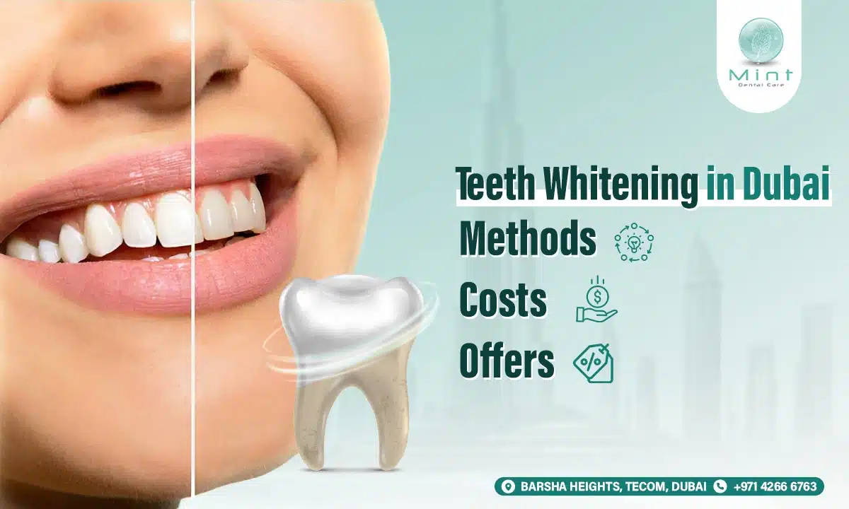 Teeth Whitening in Dubai Methods, Costs, and Offers