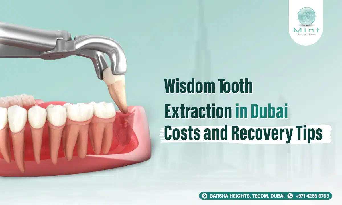 Root Canal Treatment in Dubai How to Save Your Tooth