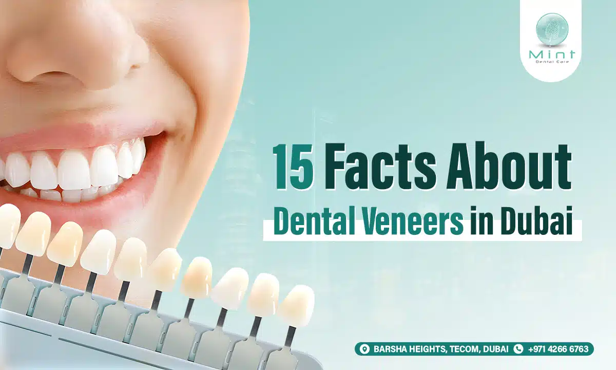 15 Facts About Dental Veneers in Dubai