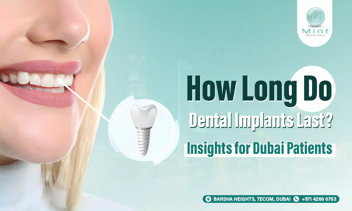 How Long Do Dental Implants Last? Insights for Dubai Patients