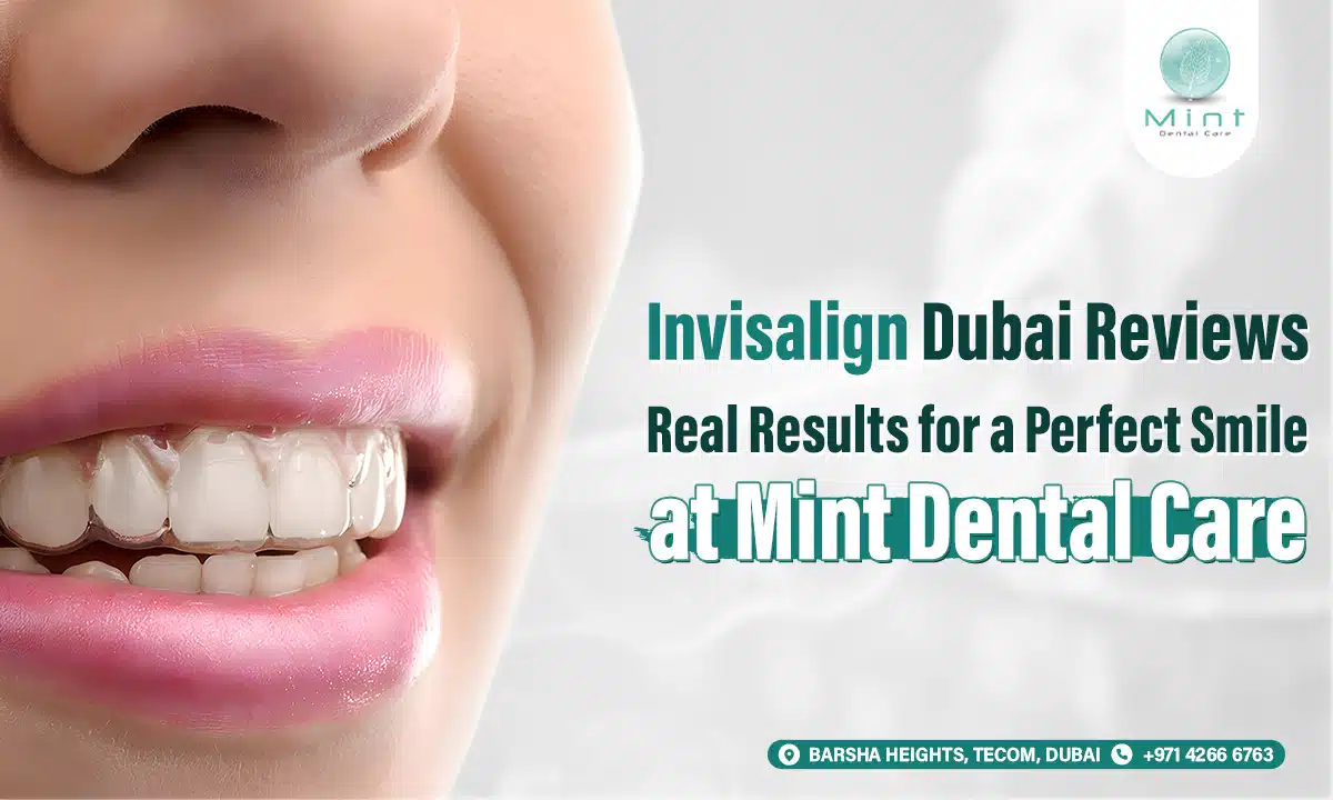 Invisalign Dubai Reviews: Real Results for a Perfect Smile at Mint Dental Care