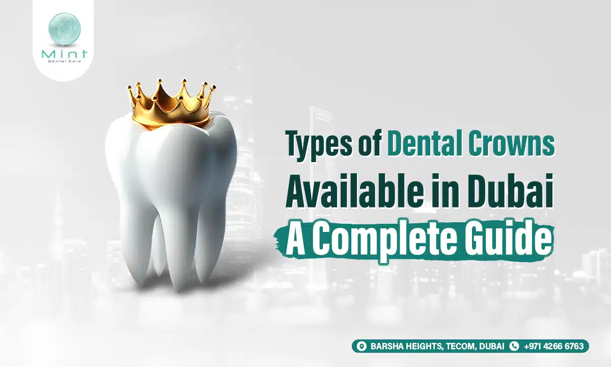 Types of Dental Crowns Available in Dubai: A Complete Guide