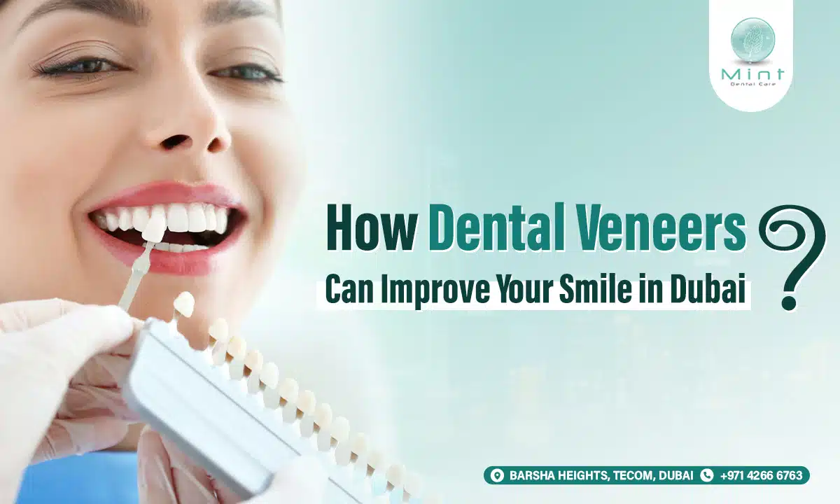 How Dental Veneers Can Improve Your Smile in Dubai