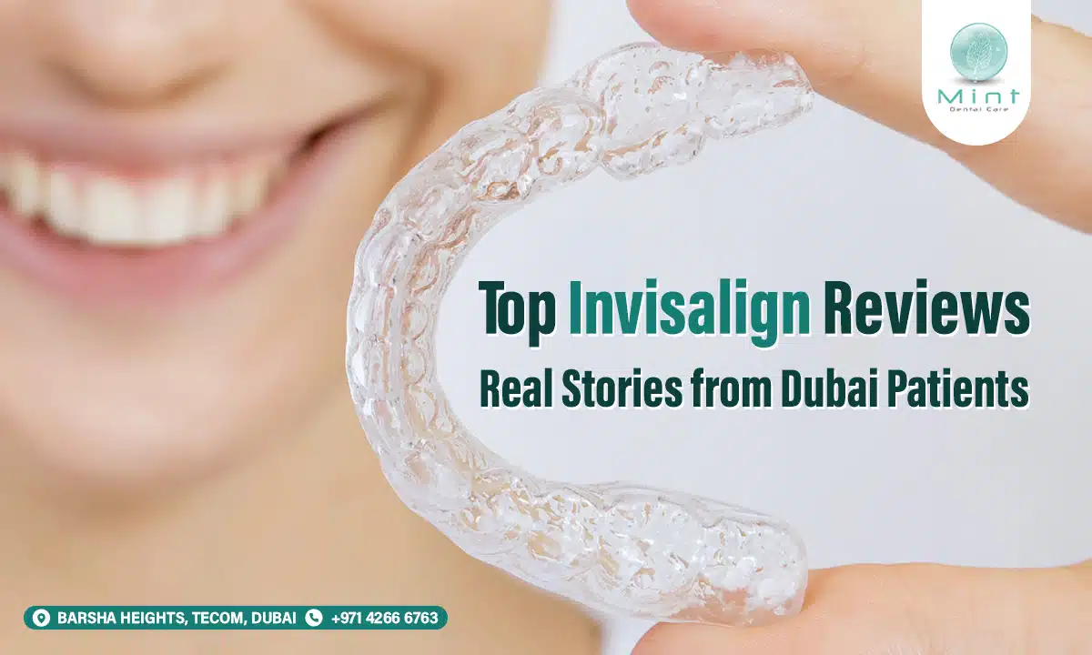 Top Invisalign Reviews: Real Stories from Dubai Patients