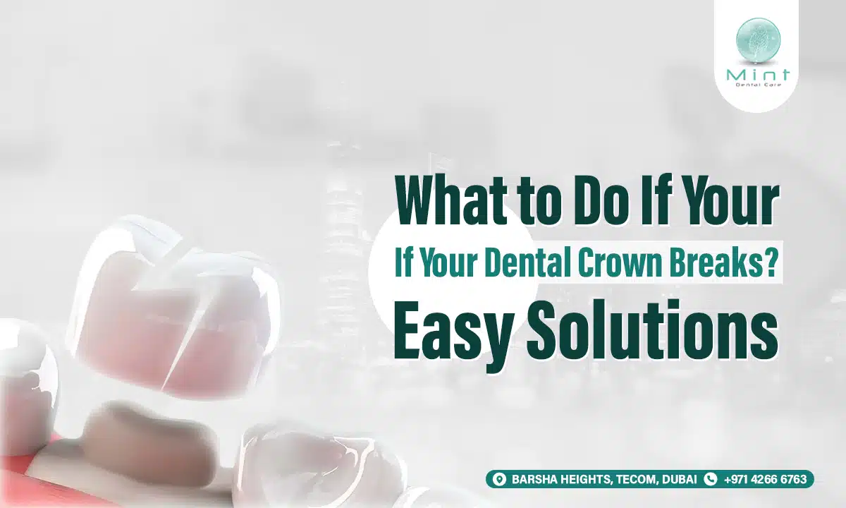 What to Do If Your Dental Crown Breaks? Easy Solutions