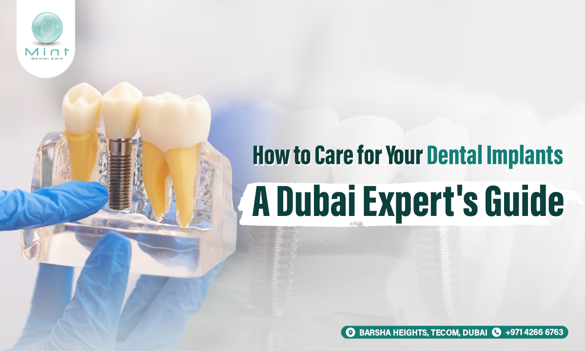 How to Care for Your Dental Implants: A Dubai Expert's Guide