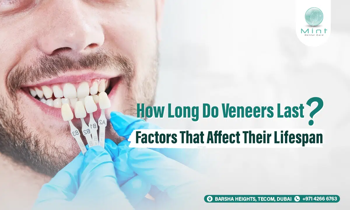 How Long Do Veneers Last? Factors That Affect Their Lifespan