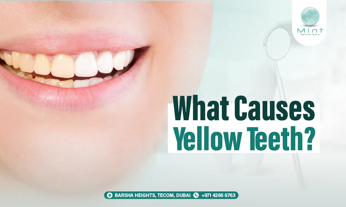 What Causes Yellow Teeth? Understanding Stains and Discoloration