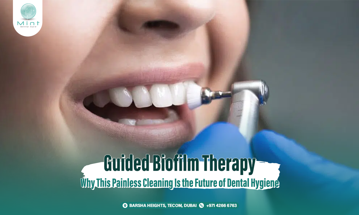 Guided Biofilm Therapy: Why This Painless Cleaning Is the Future of Dental Hygiene