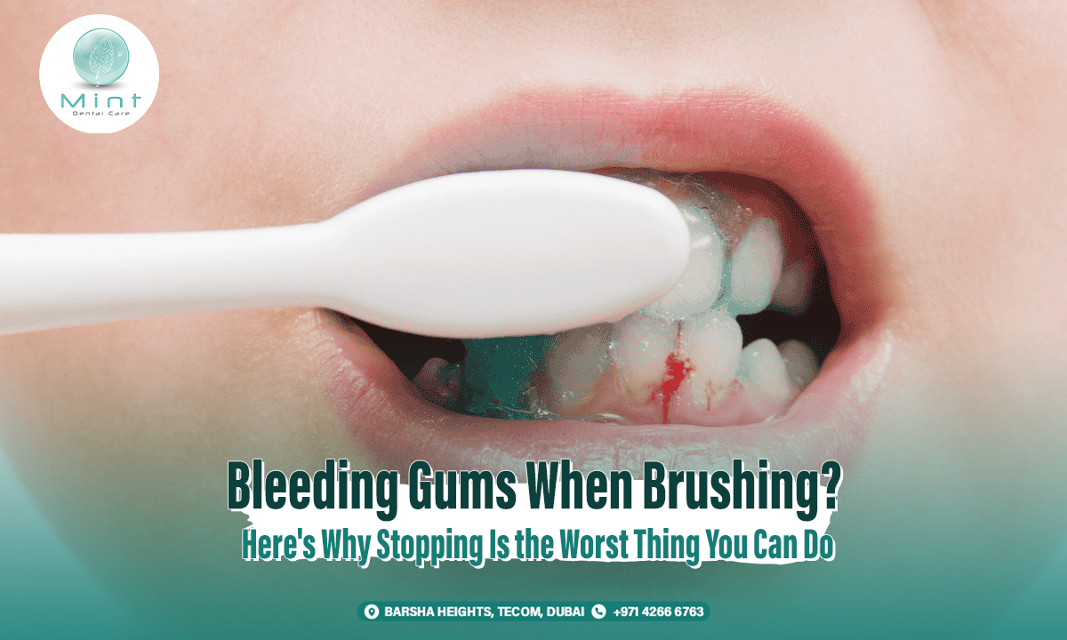 Bleeding Gums When Brushing? Here’s Why Stopping Is the Worst Thing You Can Do