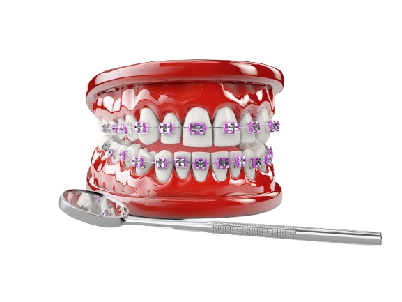 Teeth with brackets dental care concept 3d illustration