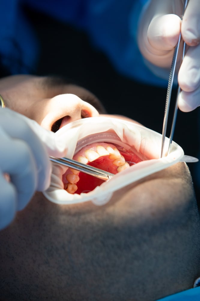 أخصائي علاج الجذور في Mint Dental Care