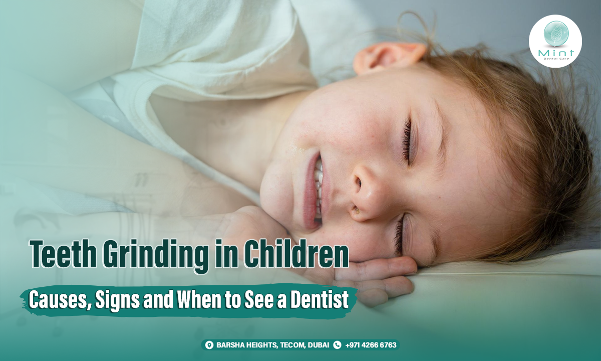 Mint Dentals Dubai