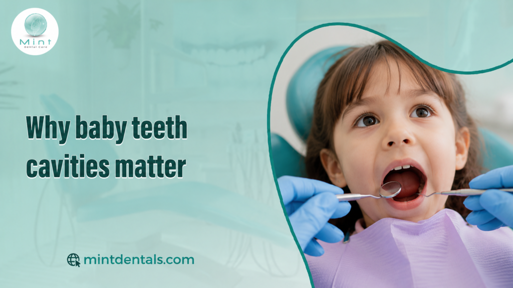 Why baby teeth cavities matter