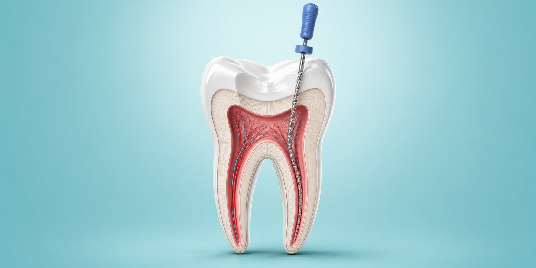 Root Canal Treatment